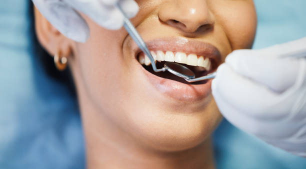 Best Emergency Broken Tooth Repair in Hallettsville, TX