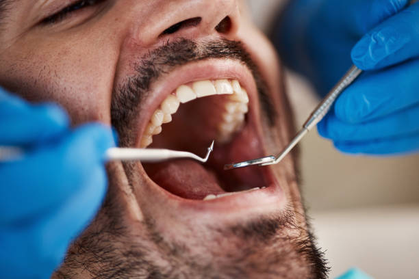 Best Emergency Dental Surgery in Hallettsville, TX